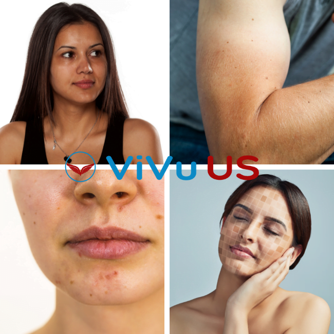 Da đen ảnh hưởng như thế nào 