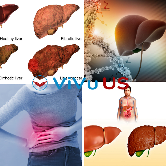 bệnh gan nguy hiểm như thế nào