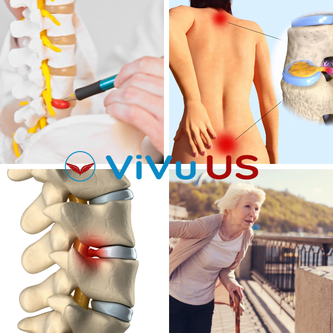 THOÁT VỊ ĐĨA ĐỆM NGUY HIỂM KHÔNG ? 