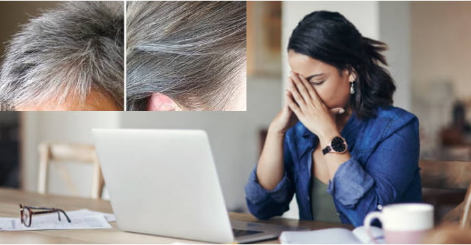 Bạn có biết: Tâm lý căng thẳng, stress thường xuyên là thủ phạm gây tóc bạc sớm?