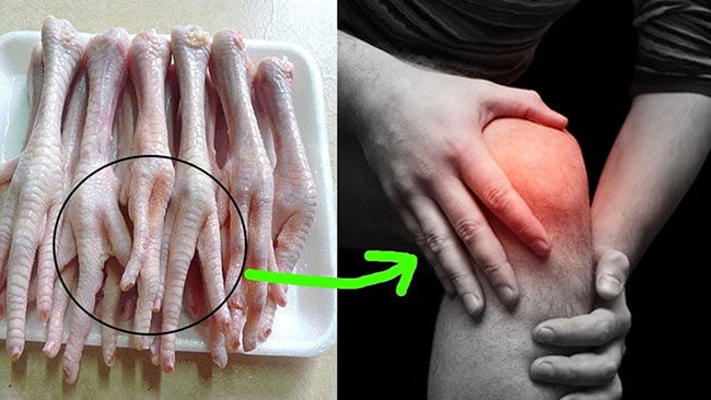 Cách chữa bệnh đau xương khớp bằng chân gà