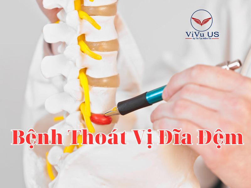 Benh thoat vi dia dem